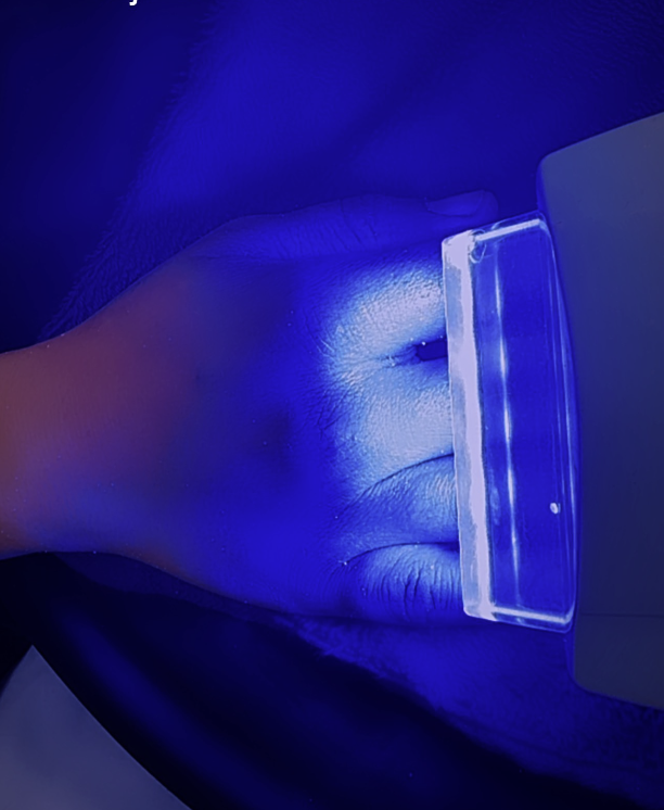 Tratamiento facial con luz LED